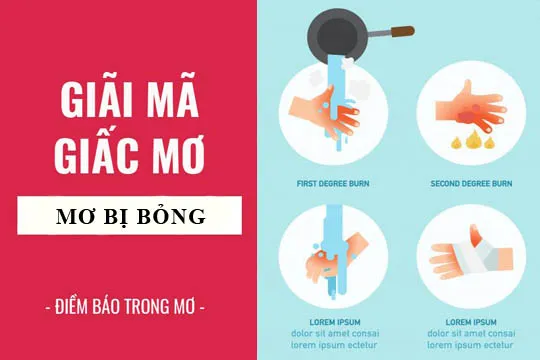 Giải mã giấc mơ: Nằm mơ thấy bị bỏng điềm báo gì, lành hay dữ? con số liên quan