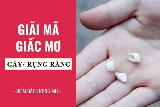 Giải mã giấc mơ: Nằm mơ thấy gãy răng, rụng răng điềm báo gì, lành hay dữ? con số liên quan