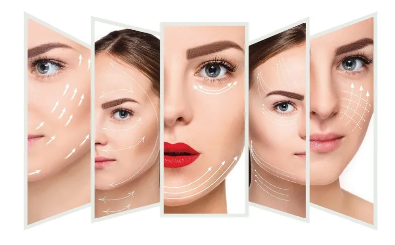 Mất bao lâu để sợi collagen đẹp? Ưu điểm và nhược điểm của phương pháp này là gì?